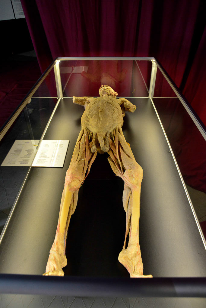 Ganzkörperplastinat im Zelt im Hochformat