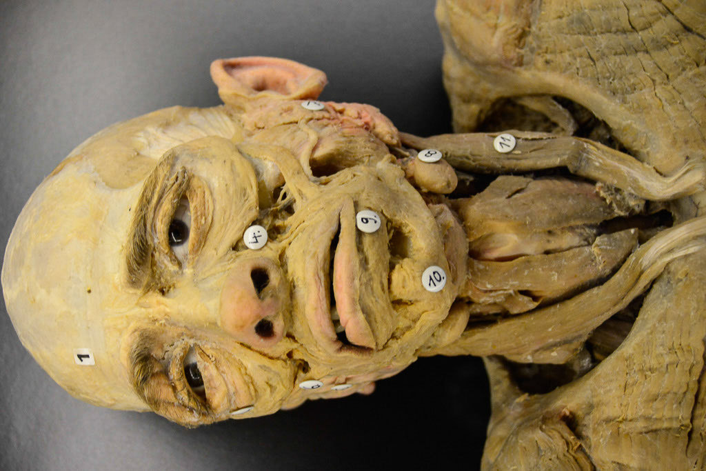 Plastinat eines Kopfes