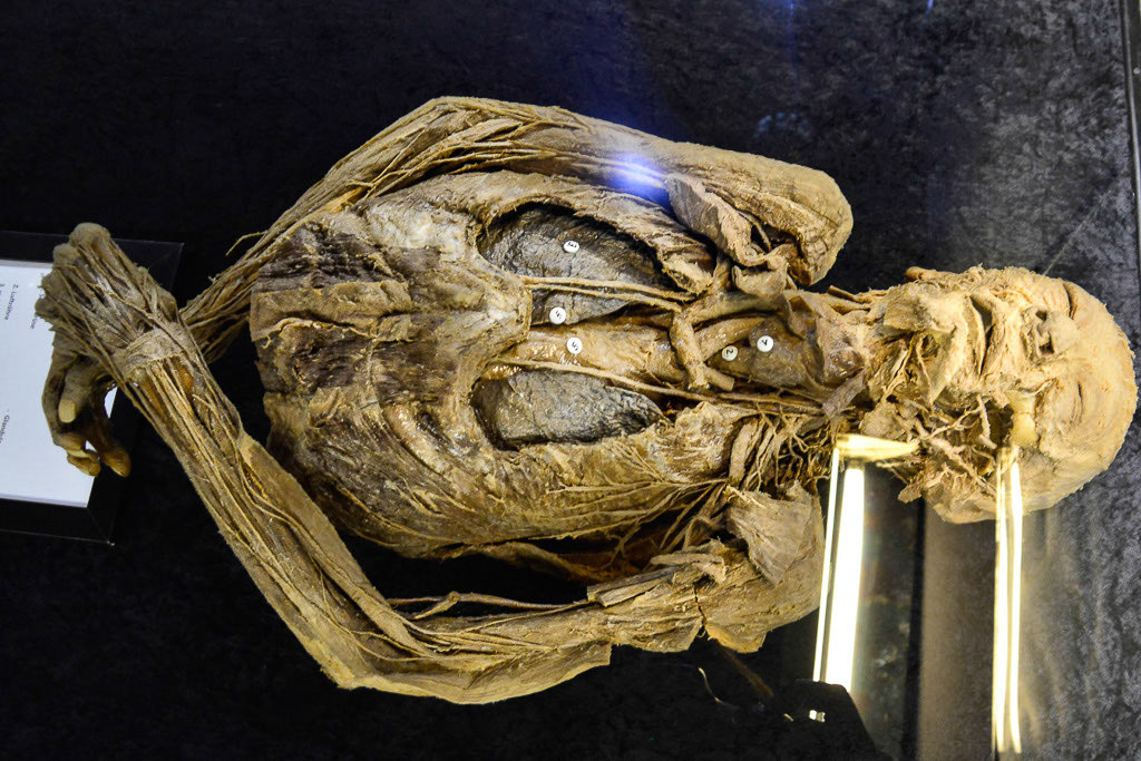 Plastinat in einer Vitrine