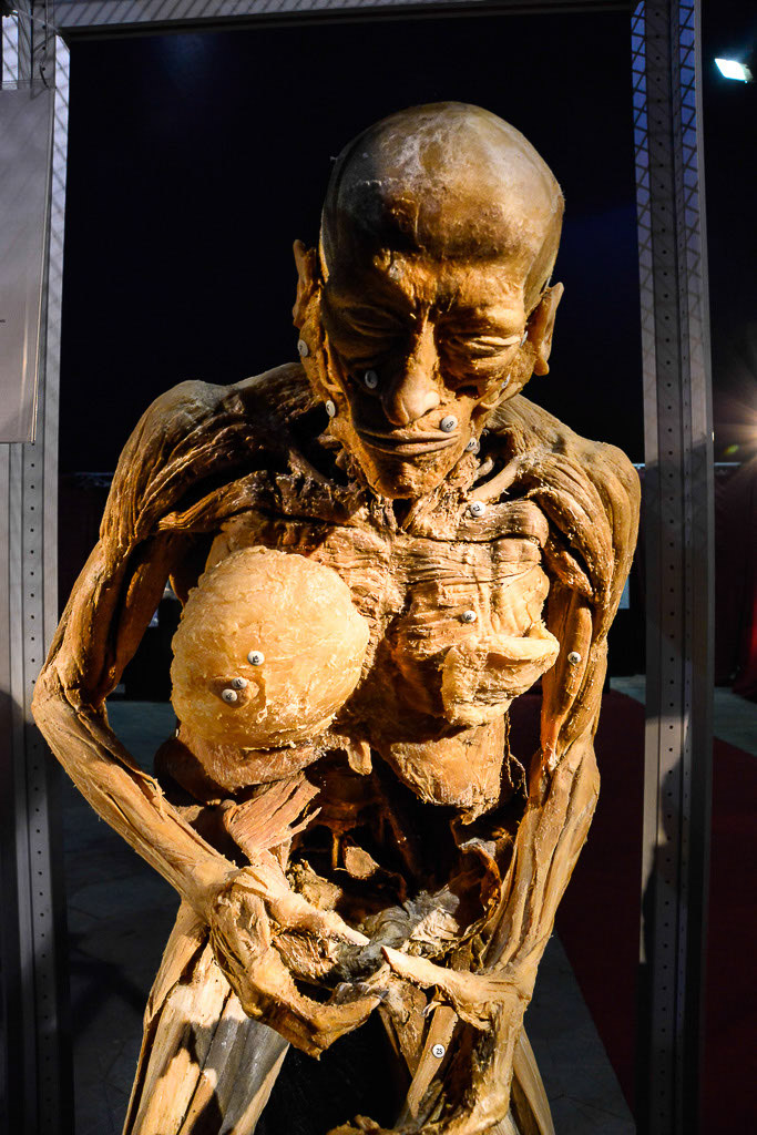 Plastinat mit freigelegten Organen im Hochformat