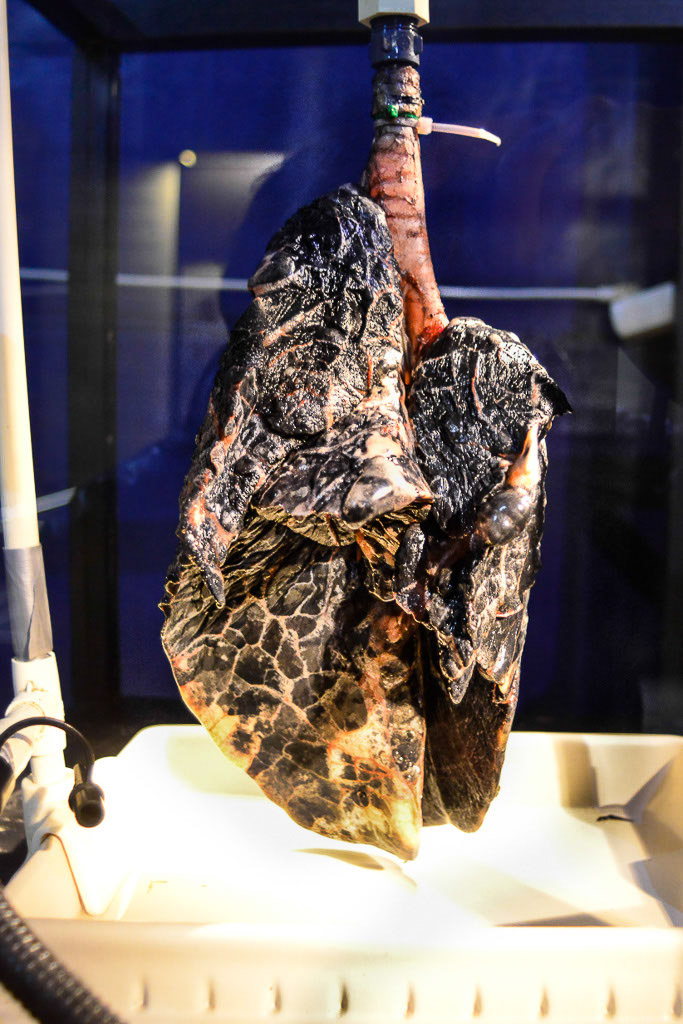 Plastinierte Lunge im Hochformat