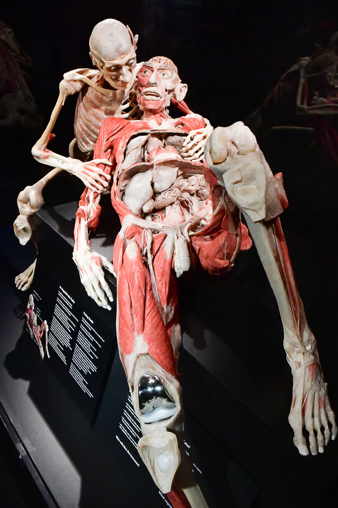 Ganzkörperplastinat im Hochformat